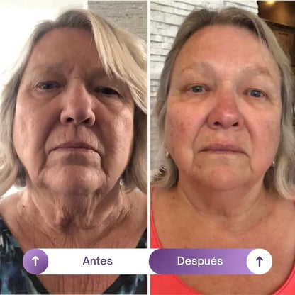 NAD+RESVERATROL - SUPLEMENTO ANTIEDAD