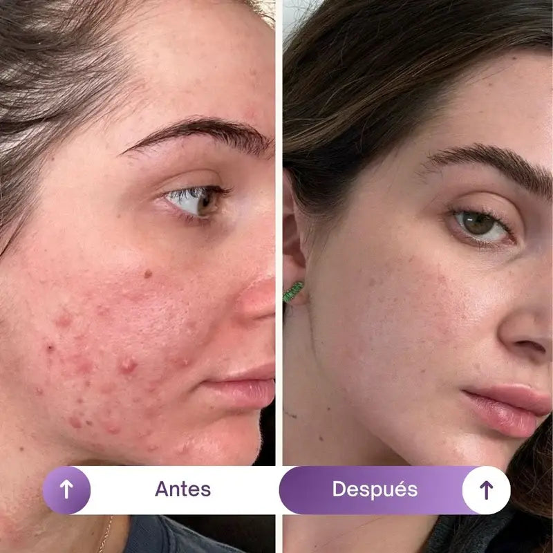 NAD+RESVERATROL - SUPLEMENTO ANTIEDAD